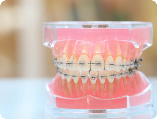 当院のインプラント治療